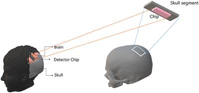 Are Brain–Computer Interfaces Feasible With Integrated Photonic Chips?